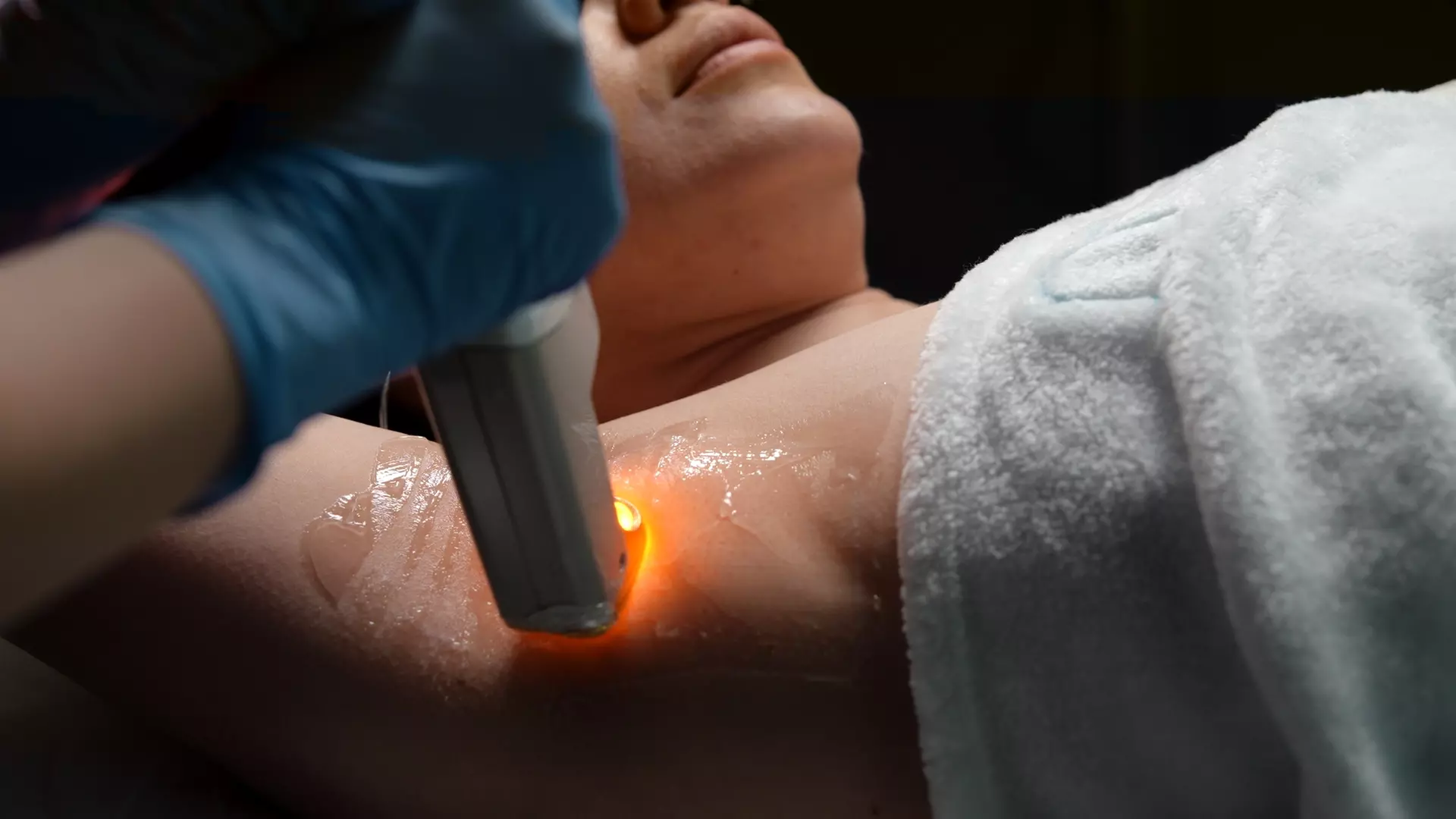 Up to 65% Off on Laser Hair Removal at NovaPiel Med Spa