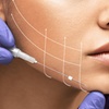 Image 2: Up to 64% Off on Facelift - Thread Lift at DermAlign Medical Aesthetics