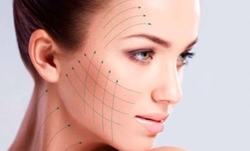 Image 1: Revitalize Your Skin with 10 or 20 PDO Smooth Threads for Face or Neck