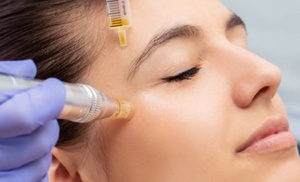 Up to 67% Off on Vampire Facelift at Tiara Skin & Hair