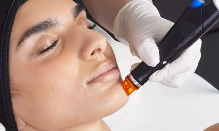 Up to 31% Off on HydraFacial at Zen Med Spa - Primary Image