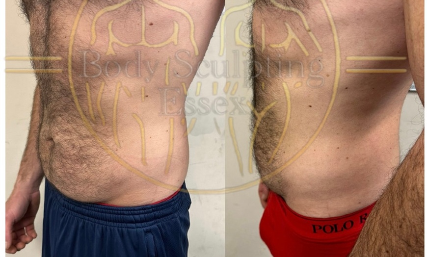 Image 2: Tone and Relax with Electromagnetic Sculpting w/ Private Sauna & More!