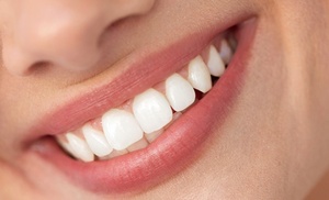 Up to 69% Off on Dental Checkup (Cleaning, X-Ray, Exam) at Smart Dental and Aesthetics Clinic