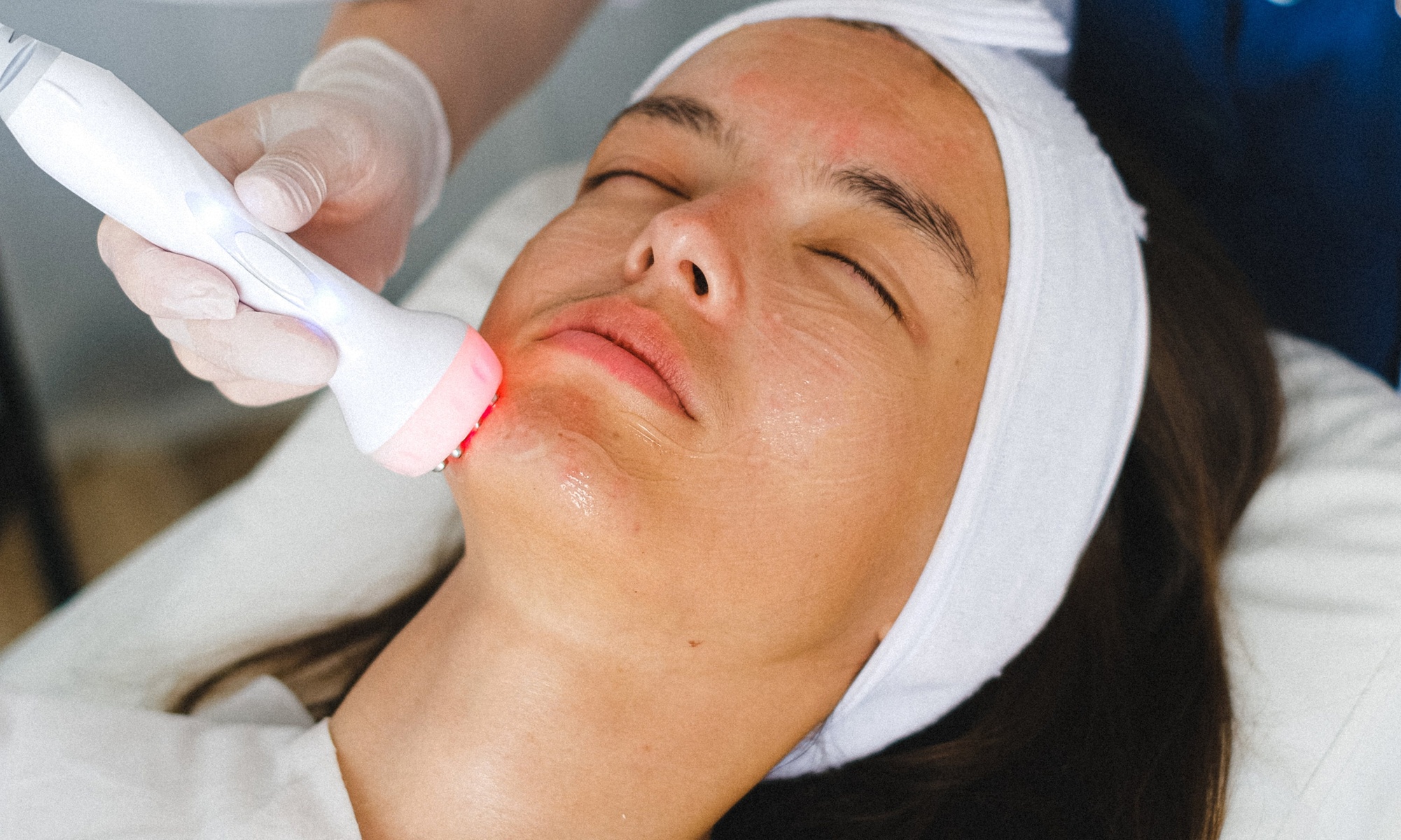 Radio Frequency Skin Tightening with Collagen Facial