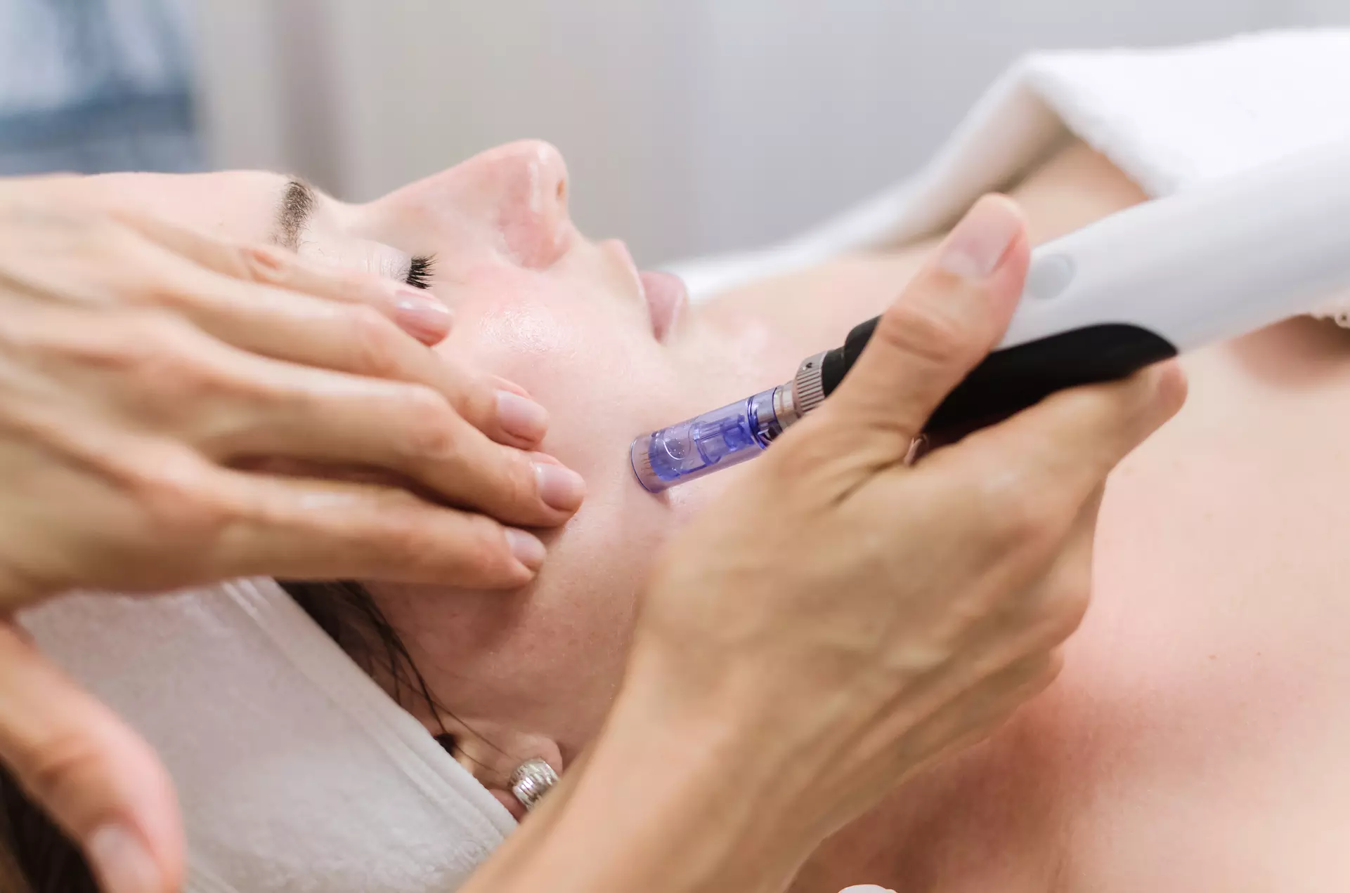 Up to 38% Off on HydraFacial at Lifestyle MedSpa - Primary Image