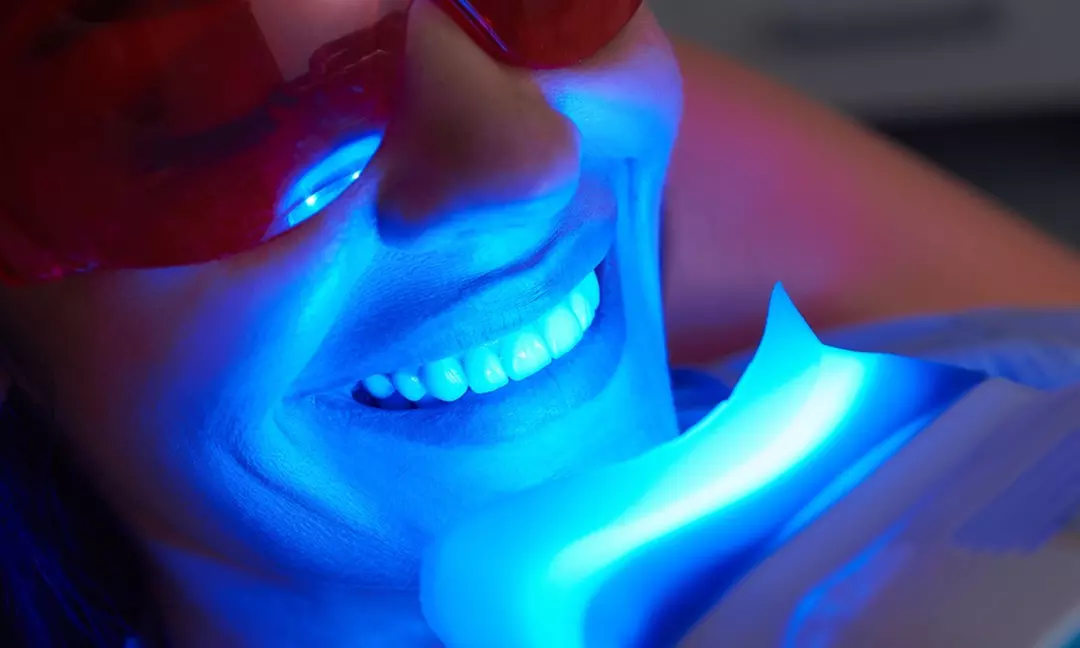 Experience Simply Glowing's innovative beauty treatments with one teeth whitening session and save up to 46% - Primary Image
