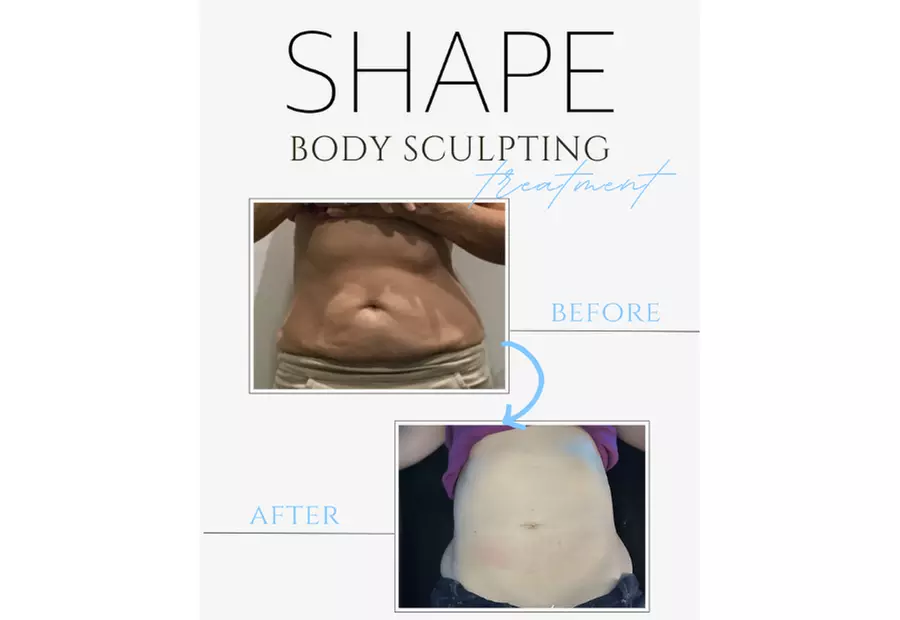 Fat Freezing Cryo Body Sculpting Packages with Big Savings