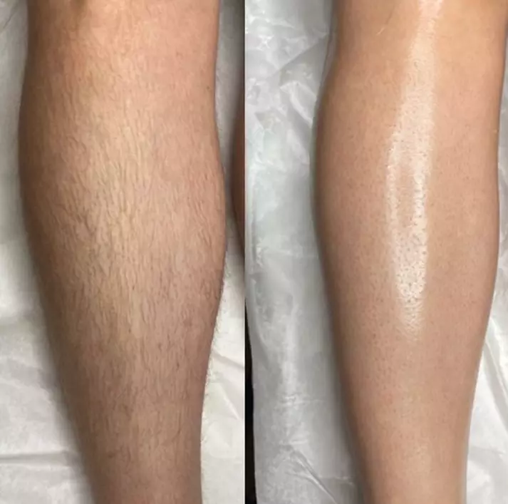 Get Smooth with Full Leg, Brazilian, or Lower Legs Wax Options