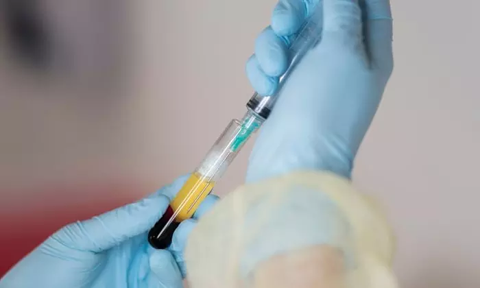 Up to 30% Off on Facial - PRP / Platelet Rich Plasma / Vampire at RESTART - Primary Image