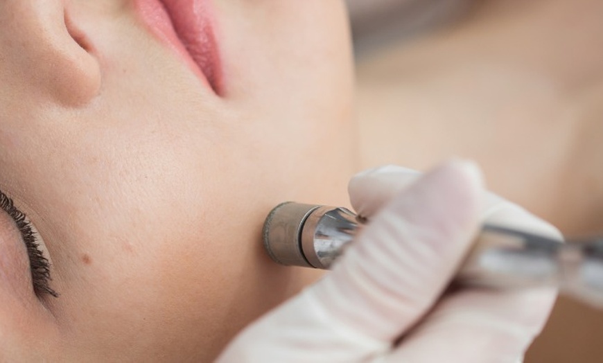 Image 2: 30-Minute Custom Facial w/ Microdermabrasion or Mechanical Exfoliation