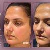 Image 4: Up to 38% Off on Injection - Dermal Filler at Divine Aesthetics Clinic London