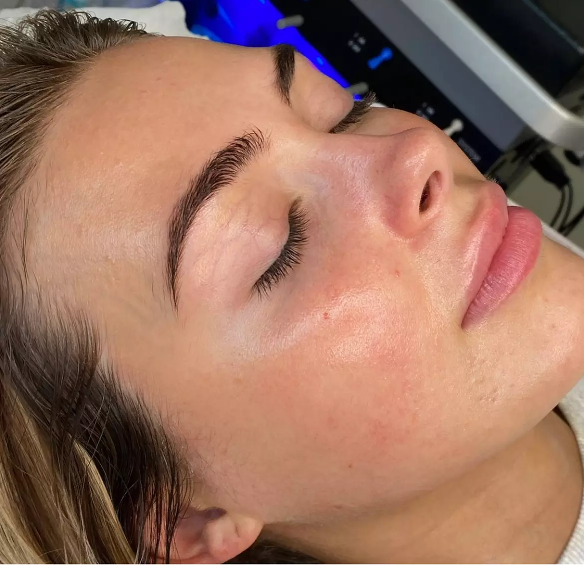 Facial - HydraFacial at Lash hq ltd - Primary Image
