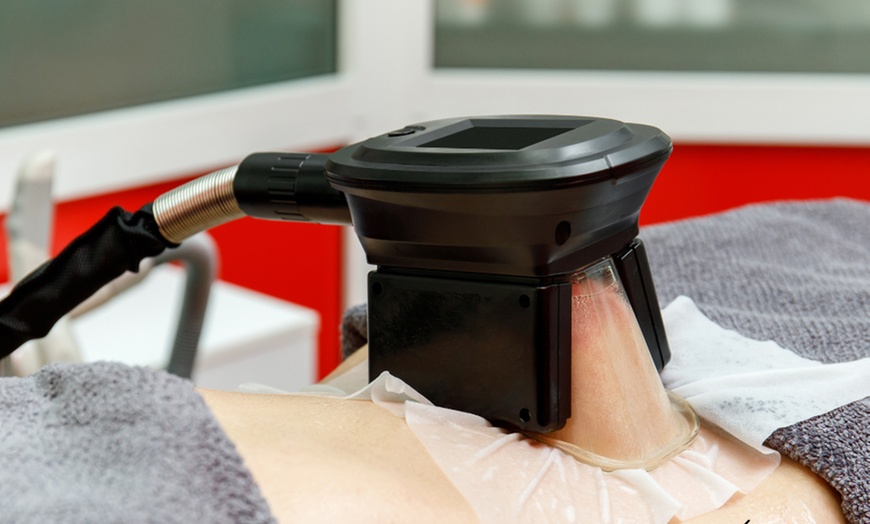 Image 3: Do 27% zniżki na Redukcja tłuszczu/cellulitu - niemarkowe w ALKU-MED | Medicine & Cosmetology