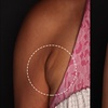Image 4: Morpheus 8 Face and Neck / Abdomen or Butt Treatment at No Pain All Gain Spa (Up to 37% Off)
