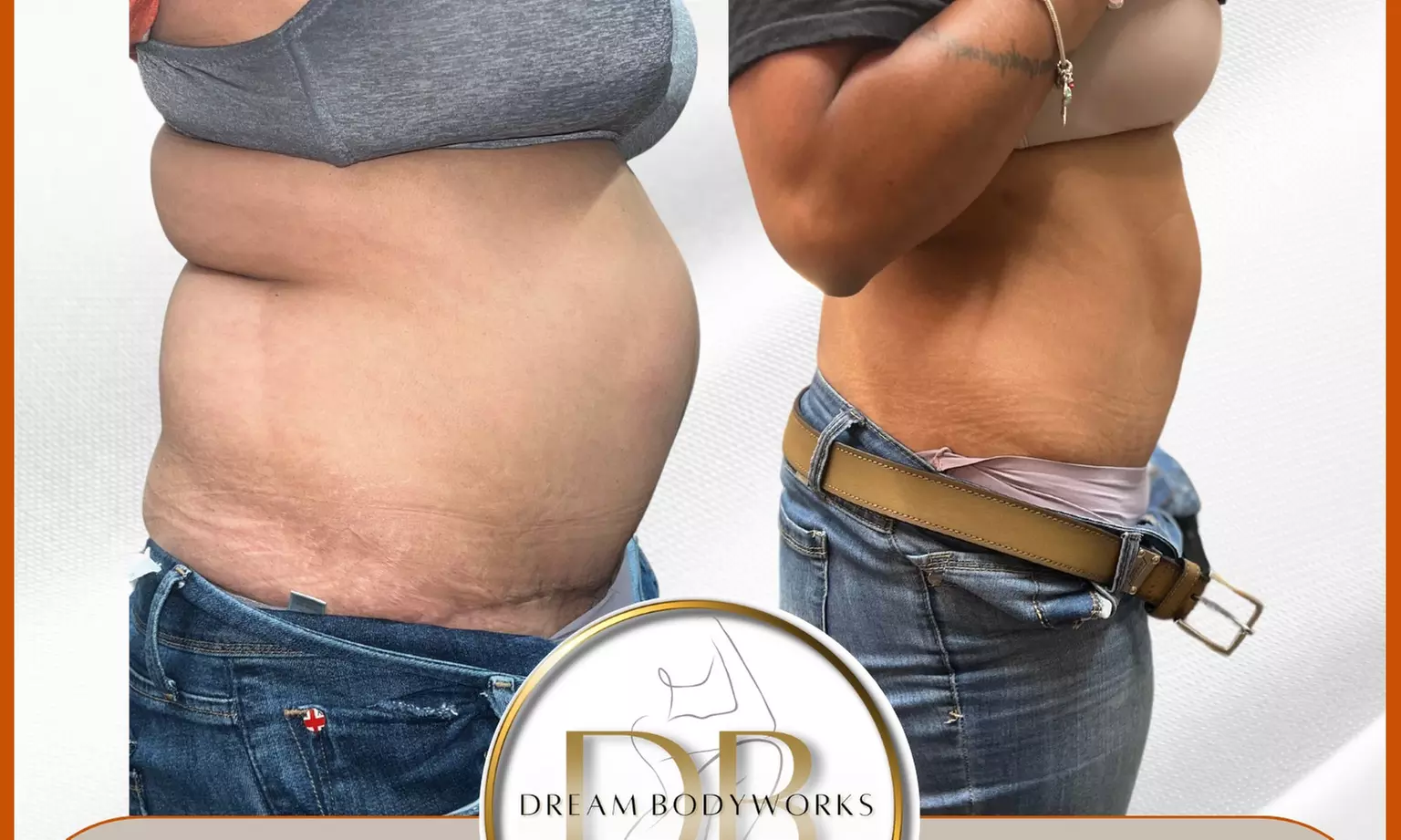 Up to 53% Off on Lymphatic Drainage Massage at Dream Bodyworks Llc