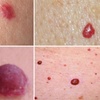Image 2: Refresh Your Skin With a 30 Min Session or Get a Follow-Up