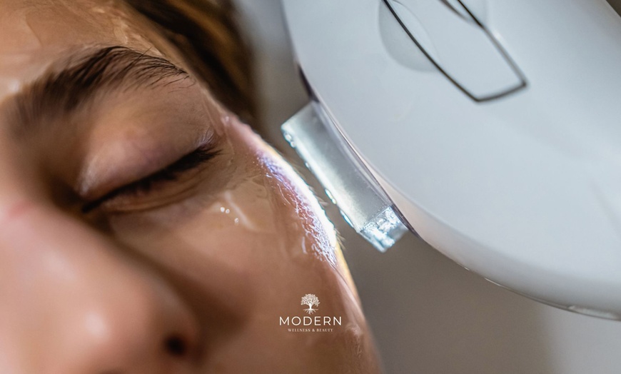 Image 3: Up to 60% Off on IPL Photo Facial at Modern Wellness & Beauty