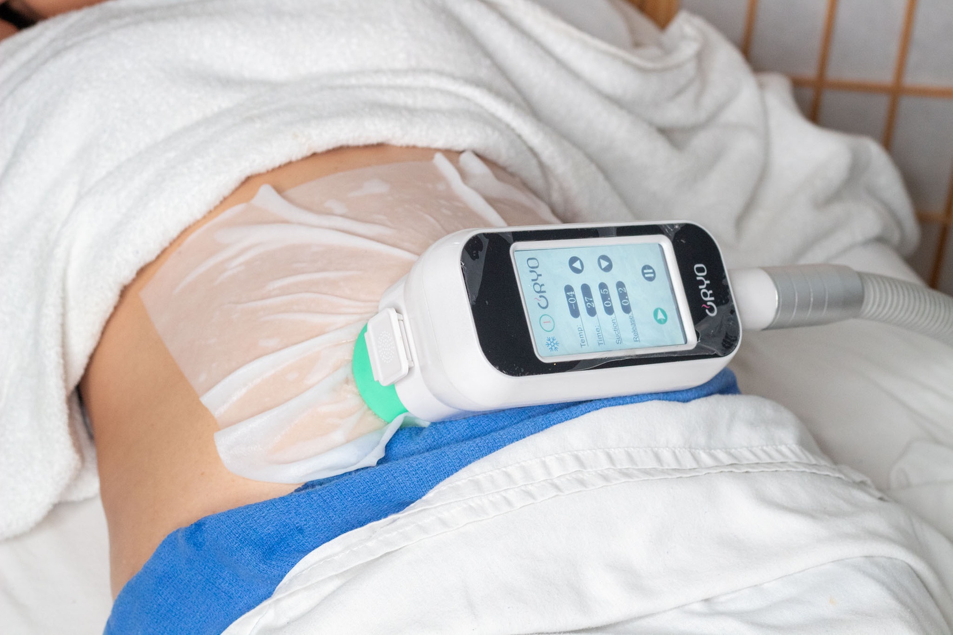Cryotherapy Sessions with Coolsculpting and Emsculpting