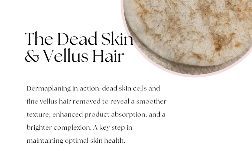 Image 6: Luxury Microneedling Facial or Microneedling Facial & Dermaplaning