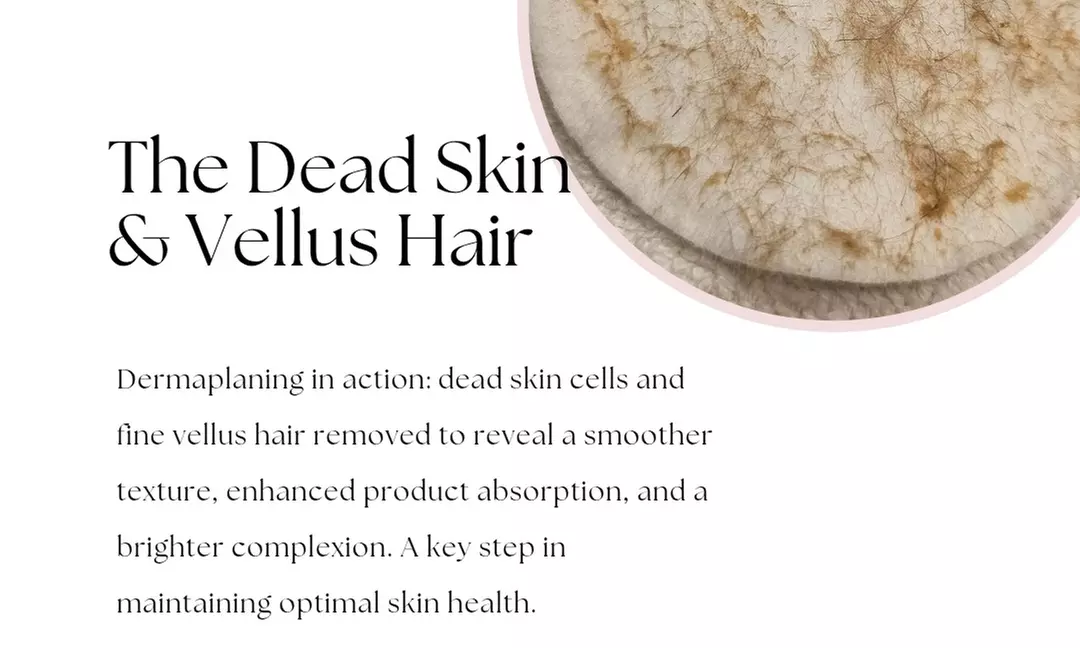 Luxury Microneedling Facial or Microneedling Facial & Dermaplaning