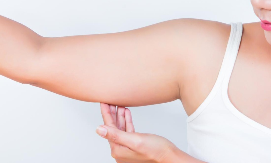 Image 1: Discover Beauty By Design's Non-Invasive Arm Treatments for Up to 92% Off