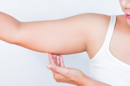 One Non-Invasive Arm Fat-Reduction Treatment - Beauty By Design