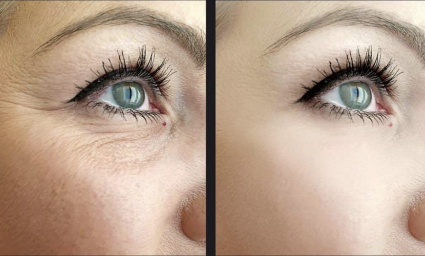 Image 2: Up to 56% Off on EZ-GEL at SkinSol Dermatology