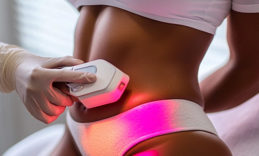 Image 1: Sculpt Your Dream Body: Non-Invasive Liposuction Awaits! 