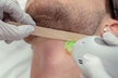 Up to 76% Off on Laser Hair Removal at Hollywood Laser Med Spa - Second Medium