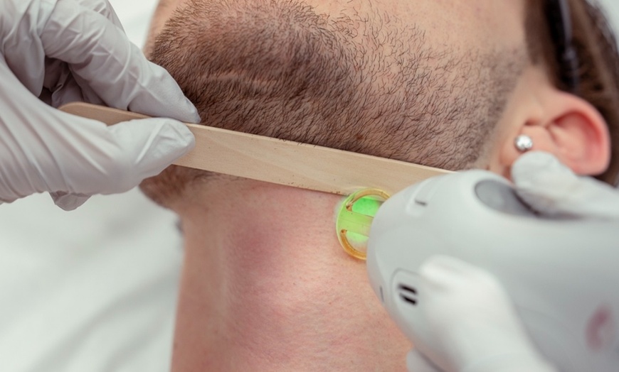 Image 6: Up to 73% Off on Laser Hair Removal at Hollywood Laser Med Spa