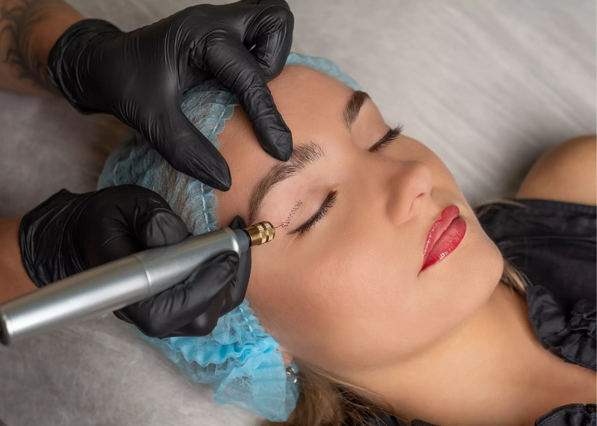 One, Two, or Three Plasma-Pen Treatments for Lips or Around Eyes at Skinovatio Medical Spa (Up to 64% Off) - Primary Image