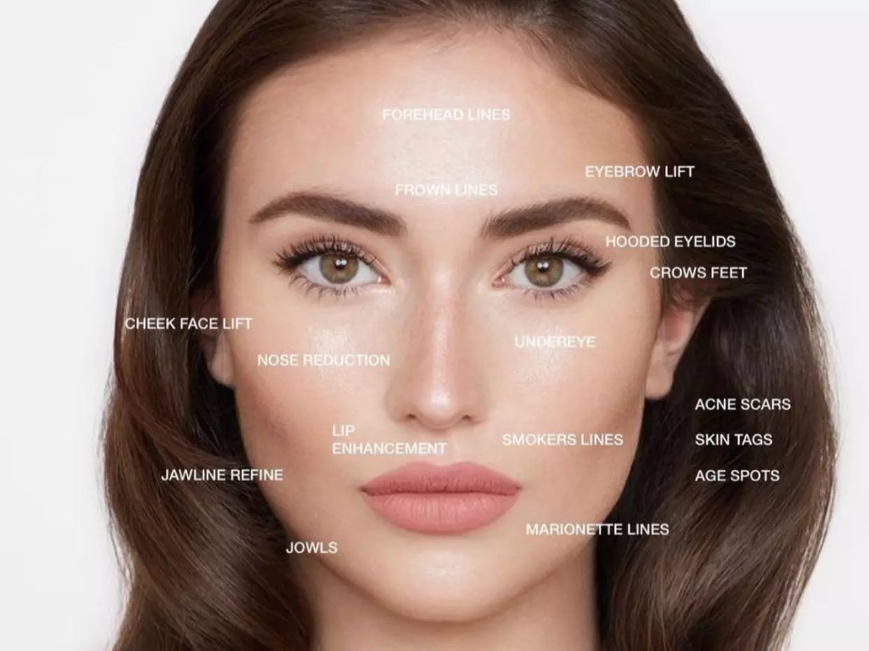 Experience Lynn Studio's Plasma Fibroblast Treatment for Small Areas, offering up to 42% off, a perfect non-surgical solution - Primary Image
