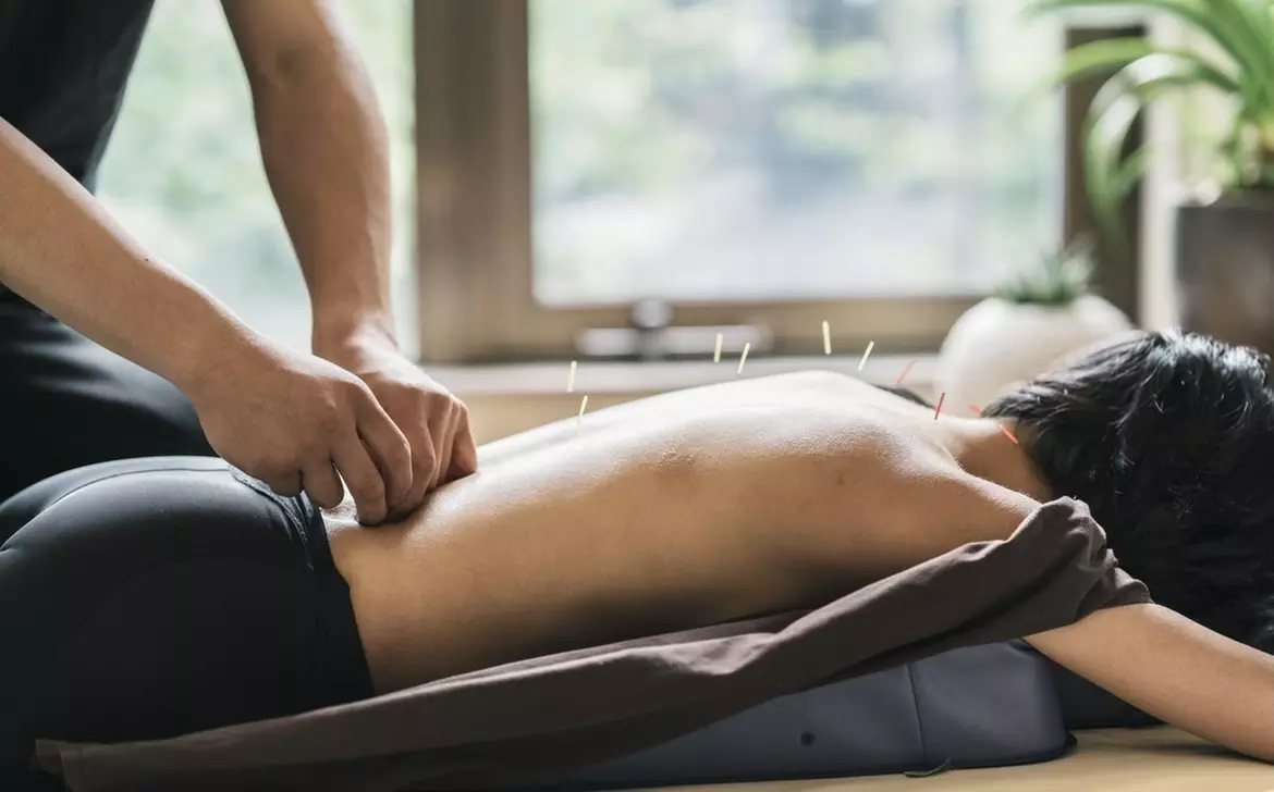 Experience Acupuncture with a Single Session
