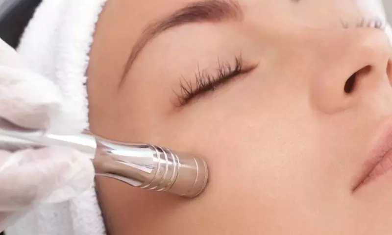 Up to 18% Off on Microdermabrasion at The Hive Esthetics LLC - Primary Image
