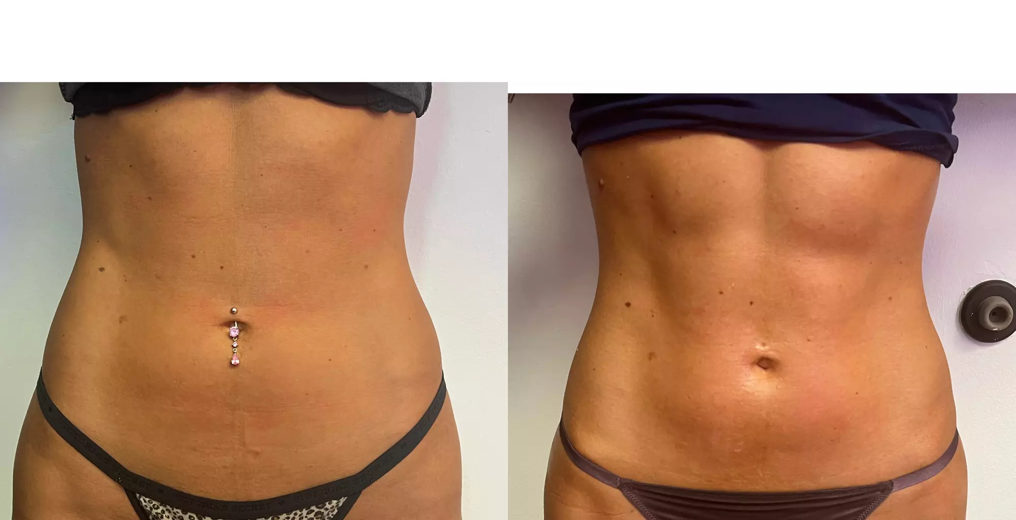 Body Contouring By Goddess Sheena offers Emsculpt 4 Sessions to shape your body up to 50% off - Primary Image