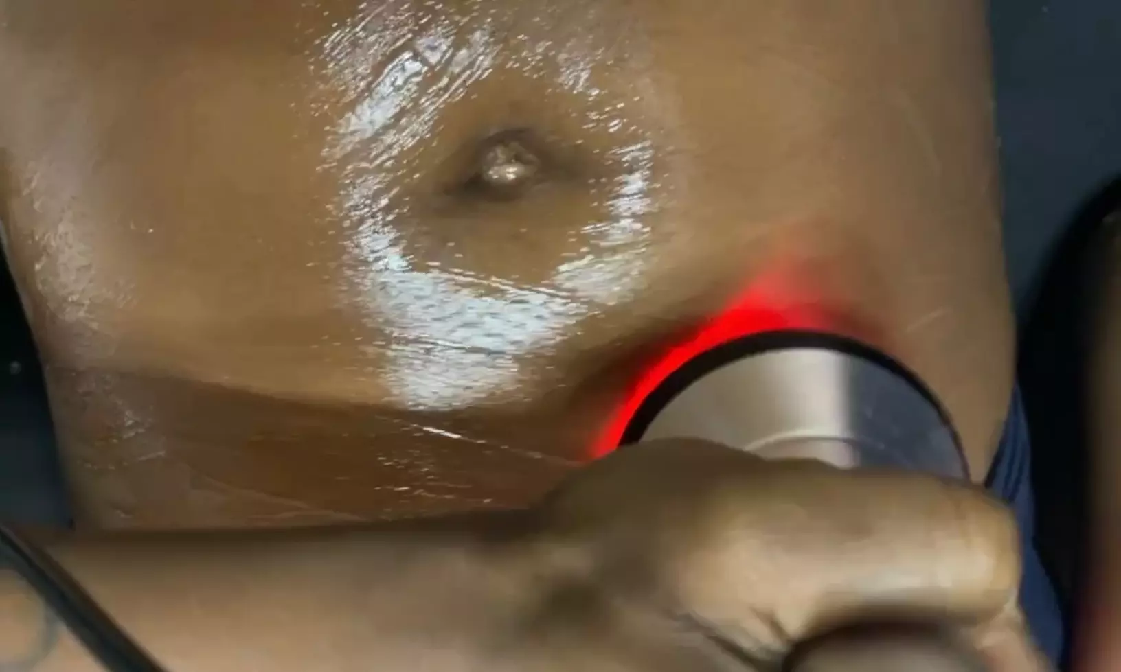 Up to 66% Off on Ultrasonic Fat Reduction at The Connoisseur of beauty - Primary Image