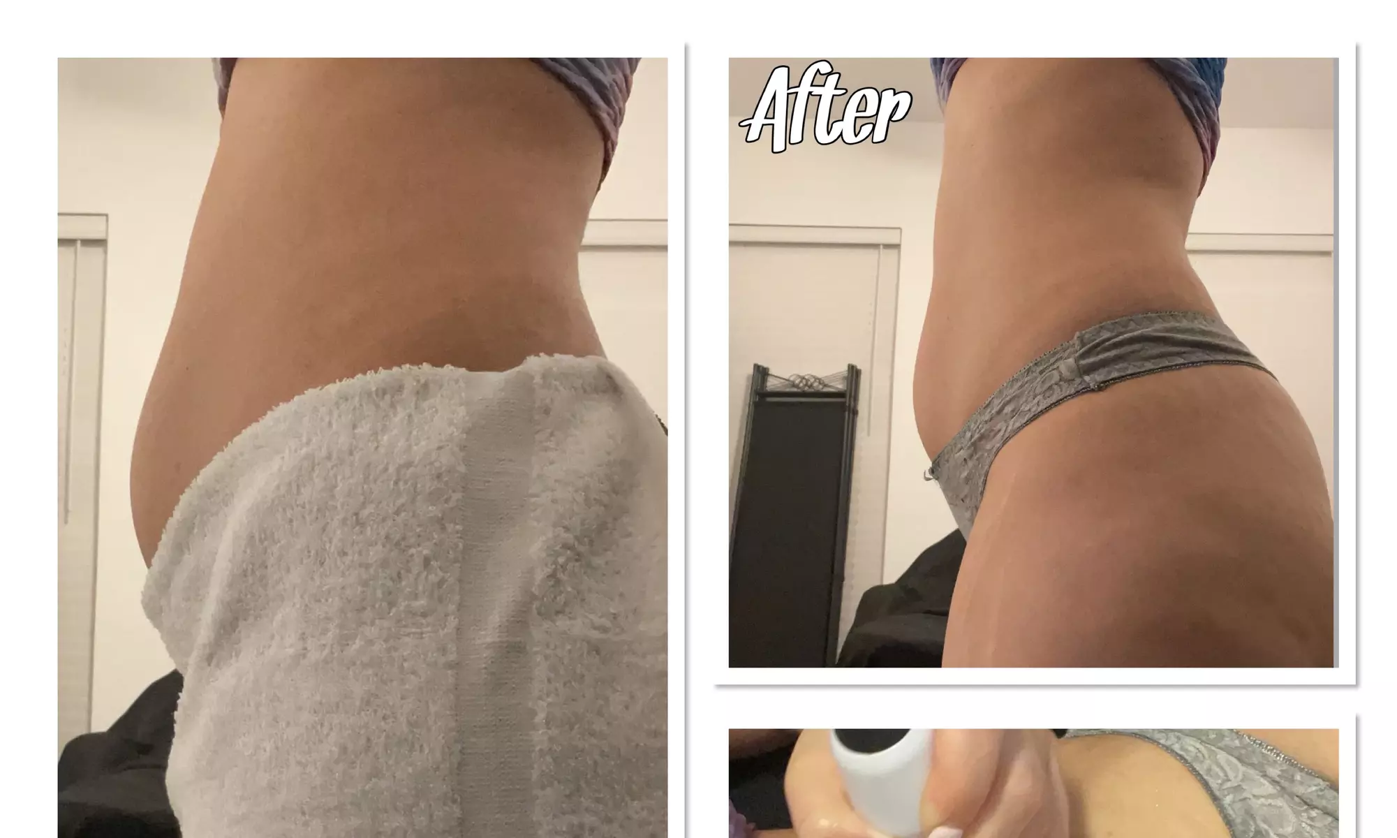 Up to 40% Off on Ultrasonic Fat Reduction at Bellebeautyclinic - Primary Image