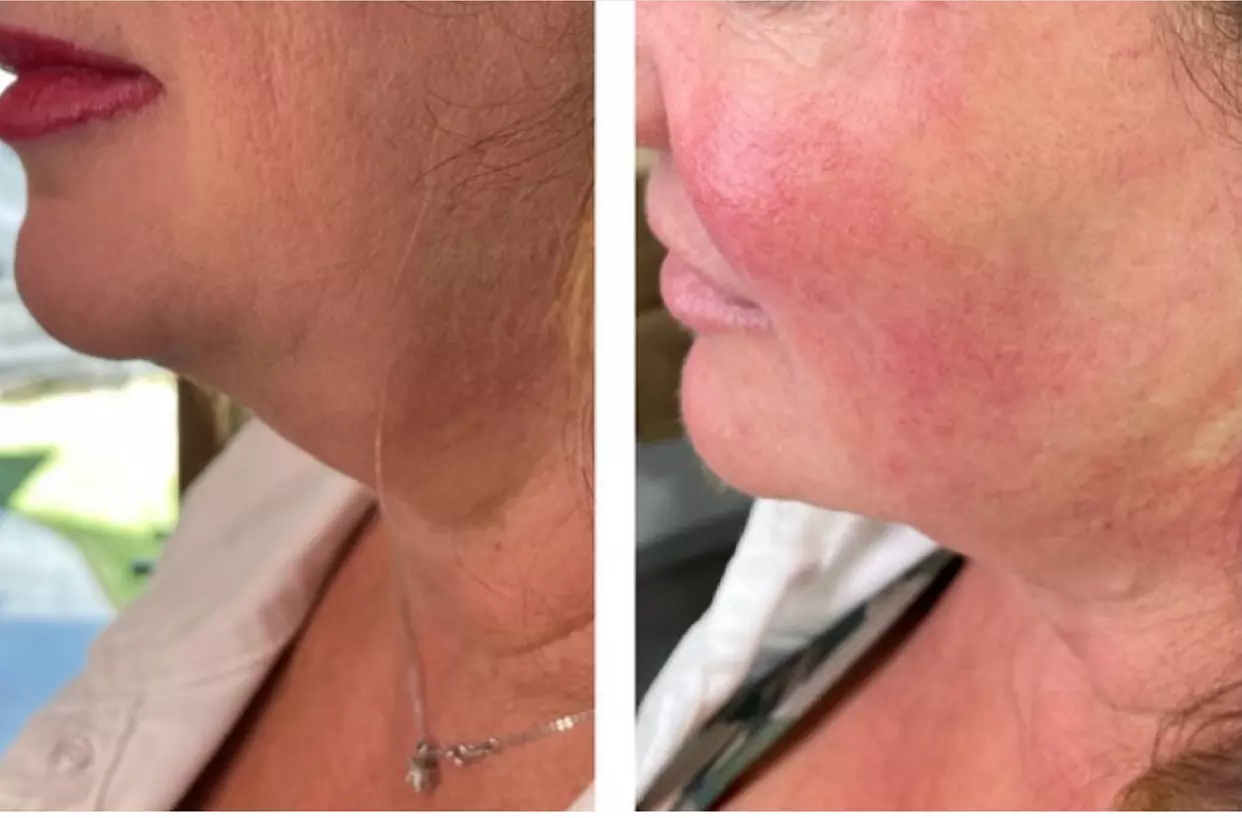 Up to 50% Off on Infrared Therapy at Holistic Health Sanctuary - Primary Image