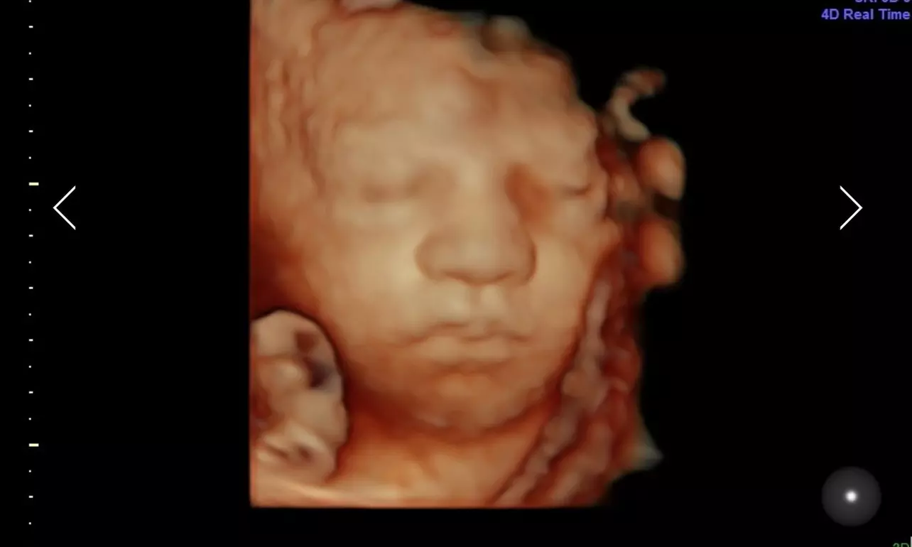 Up to 80% Off on Ultrasound - 3D / 4D at La Vita Bella North DFW - Second Medium