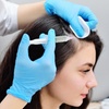 Image 2: PRP Injections for Hair Restoration or PRP Facial w/ RF Microneedling