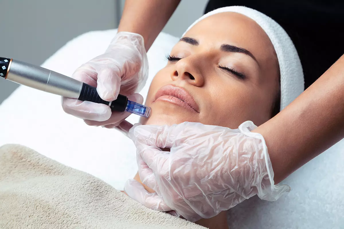 Up to 40% Off on Micro-Needling at The Skintechnician - Primary Image