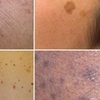 Image 3: Refresh Your Skin With a 30 Min Session or Get a Follow-Up