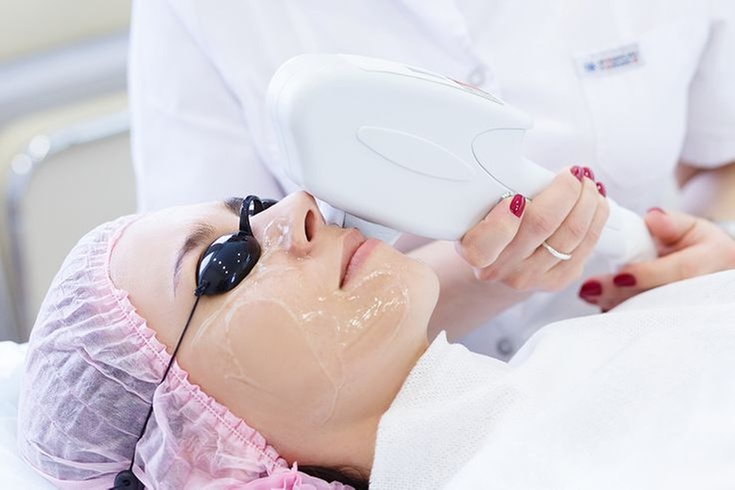 Up to 50% Off on One IPL Photofacial at Skinovatio Arlington Heights