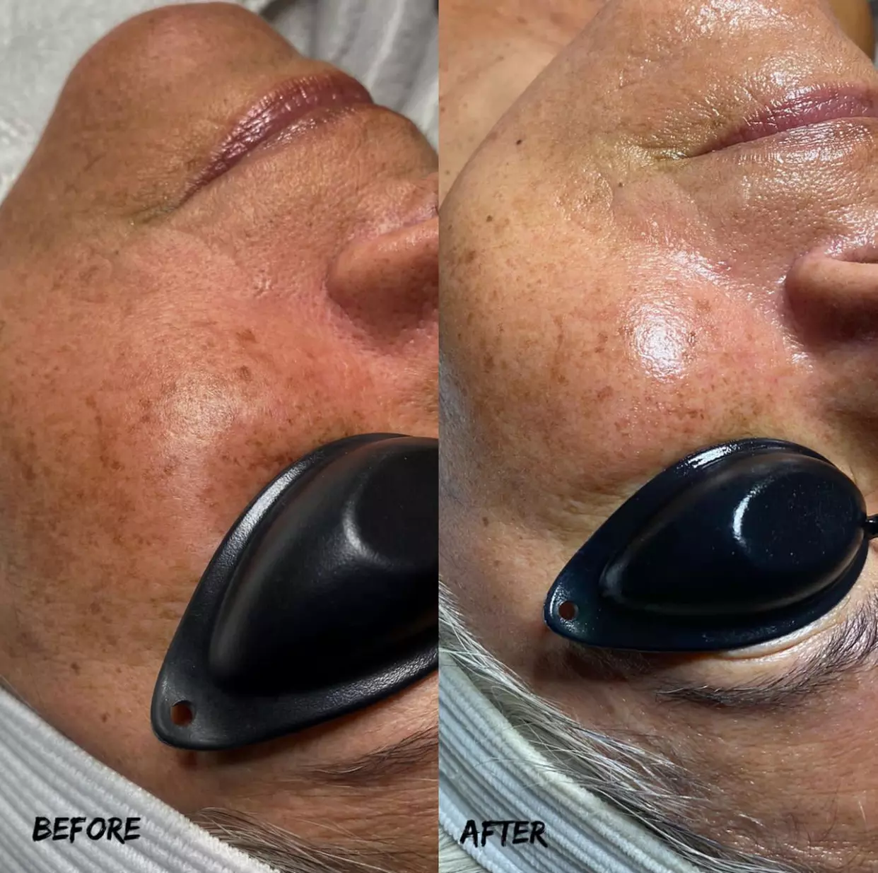Dermaplane + Hydration or 90-Minute Anti-Aging Treatment with Massage