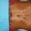 Image 4: Up to 71% Off on Cavitation at Extreme body sculpting