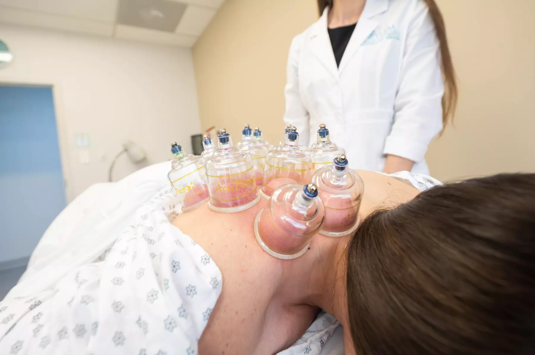 Up to 40% on Acupuncture at VUIM clinic and whole health