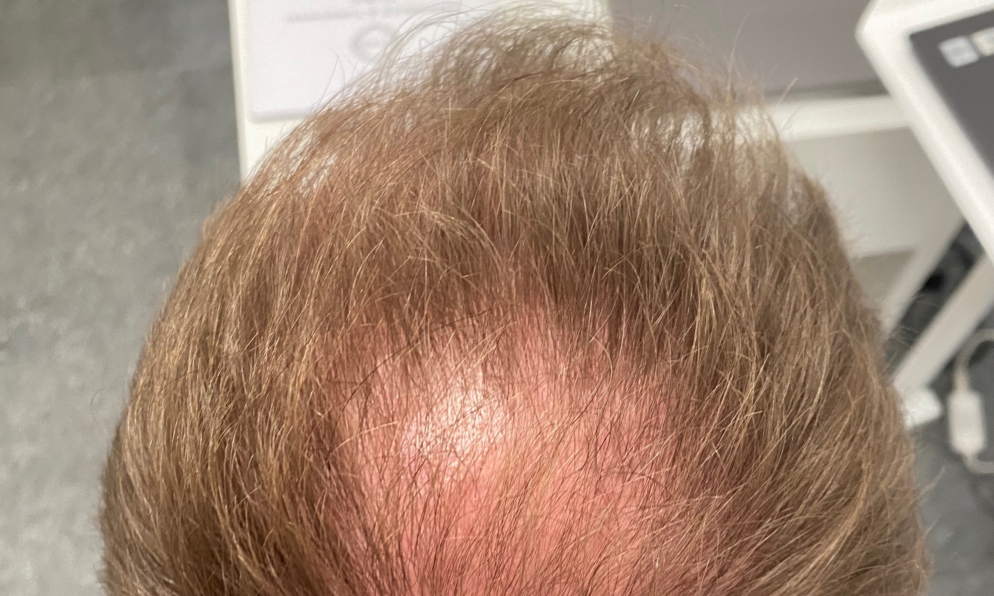 Do 38% zniżki na Zabiegi kosmetyczne w spa/salonie (usługi) w Anna Jandzińska Permanent Make Up Artist