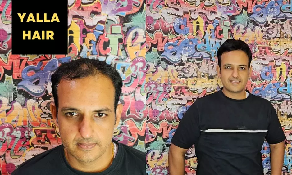 Up to 50% Off on Men's Hair Patch or Hair extensions Fixing