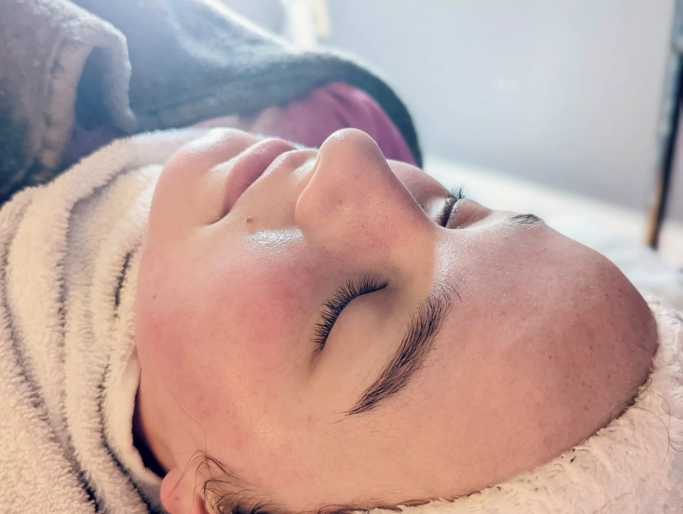 Up to 51% Off on Microdermabrasion at Luster - Primary Image