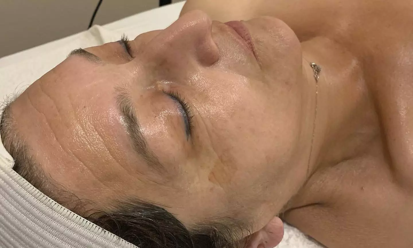Up to 50% Off on Facial at Bare Skn and Beauty - Second Medium
